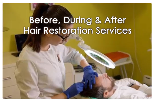 Singapore hair restoration services
