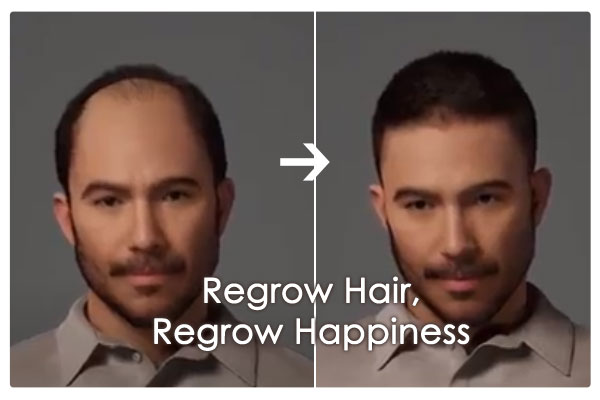 hair regrowth specialist