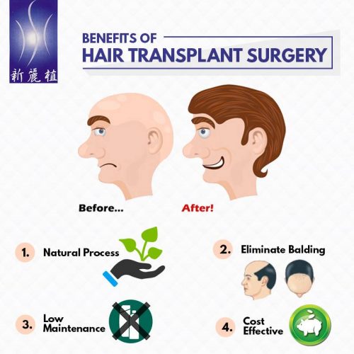 hair restoration services Singapore